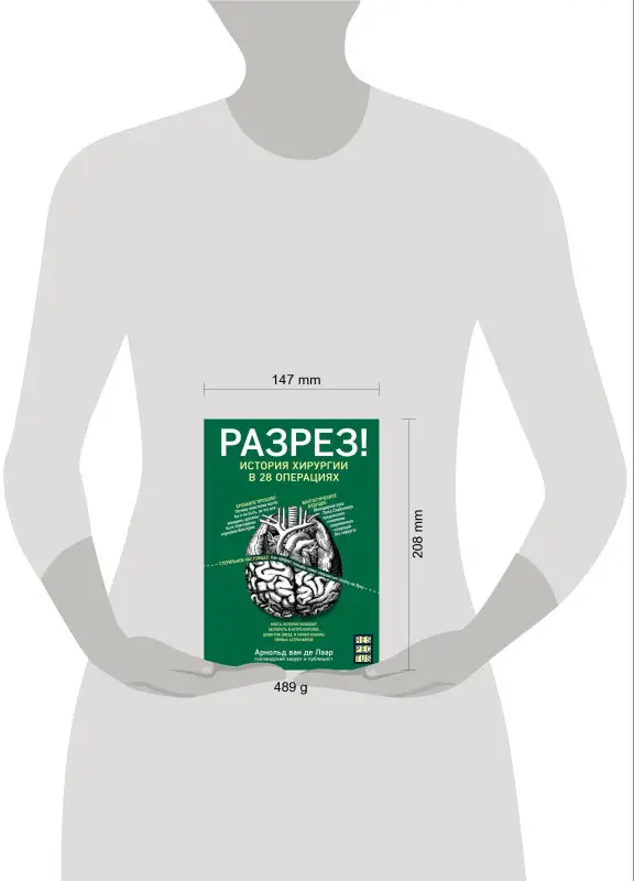Арнольд ван де Лаар. Разрез! История хирургии в 28 операциях