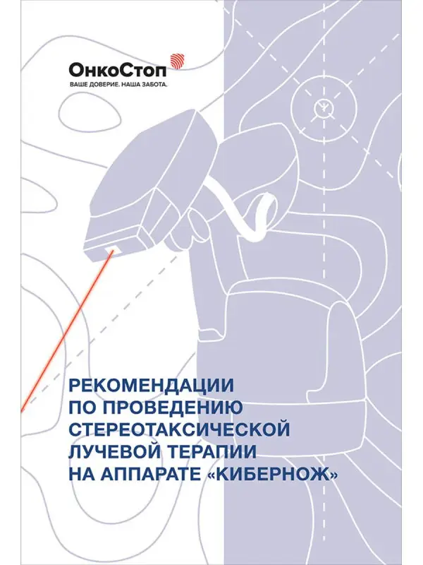 Уценка. Рекомендации по проведению стереотаксической лучевой терапии на аппарате «КиберНож»