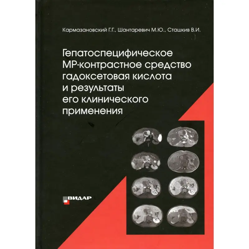 Уценка. Гепатоспецифическое МР-контрастное средство «гадоксетовая кислота» и результаты его клинического применения